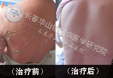 ��Ůʿ ŧ������м��+��Ƥ������м��