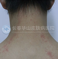 ʪ����ô����