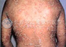 ������ţƤѢ