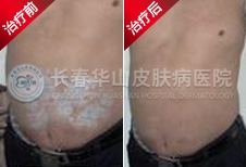 ţƤѢ���� Ȭ�������