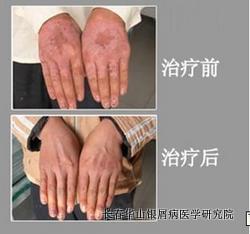 ��м��Ԥ��