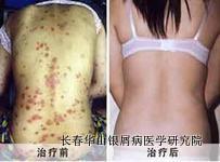 ��м��֢״����