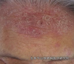 ��м��֢״����