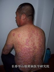 ��м��֢״����