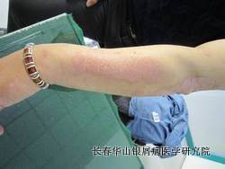 ��м��֢״����