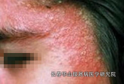 ��м��֢״����