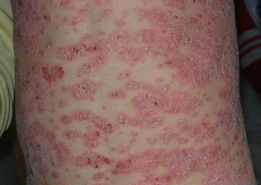 ��м������Щ֢״����