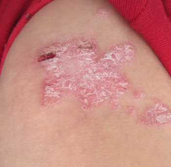 ��м������֢״����Щ