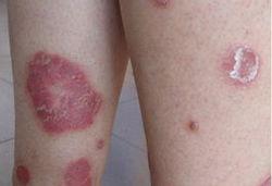 ţƤѢ��ô������ɢ