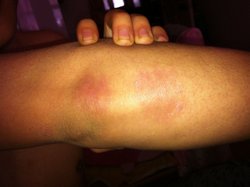 ��������Ƥ���о�Ժ