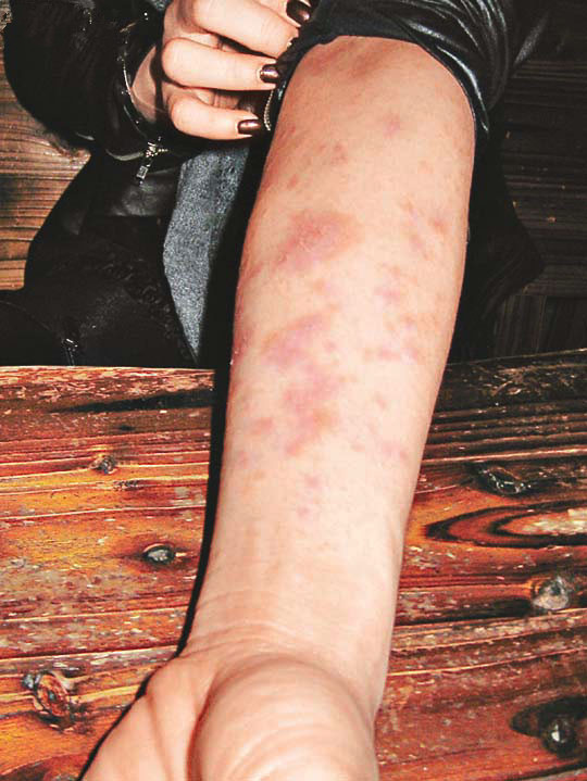 长春治皮肤病医院