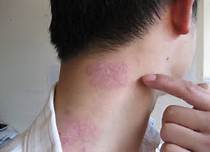 ��������ţƤѢ��ô��