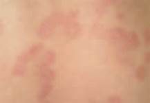 �����ļ�ţƤѢҽԺ��