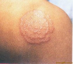 ��ô��ȷ����ţƤѢ