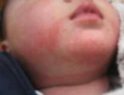 长春博润皮肤病医院好吗