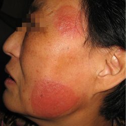 吉林省皮肤科哪家医院好