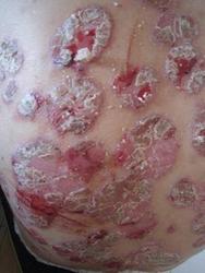 ţƤѢ����ҩ��