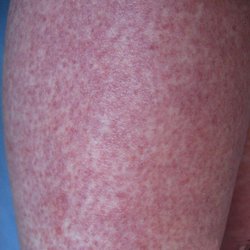 ţƤѢ����,�̶Ȳ�ͬ