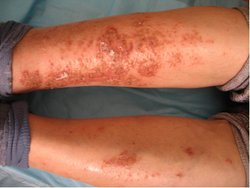 ����ţƤѢ,���Ʒ���