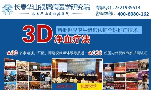 怎样避免牛皮癣疾病受到诱发的侵扰