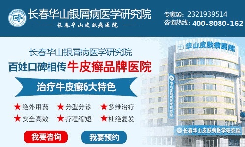 该怎样预防牛皮癣疾病