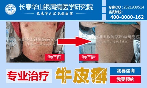 �������ܷ�ֹţƤѢ�Ĳ��鷴������