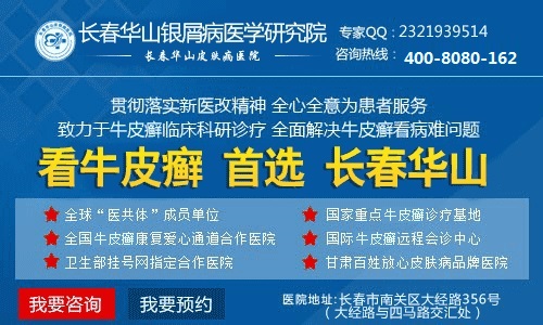 诱发牛皮癣发病的原因有哪些