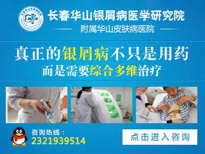 是什么原因让牛皮癣出现的