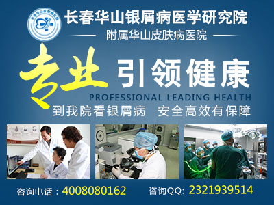 牛皮癣的危害有哪些