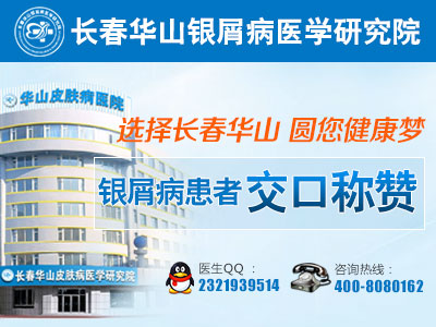 牛皮癣早期症状都有哪些