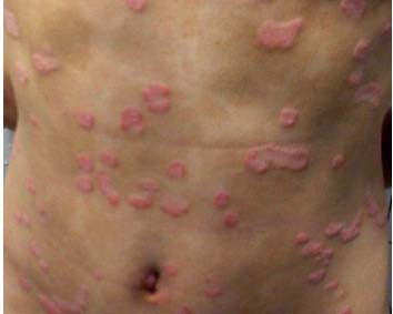 ³¤´º²©ÈóÒøÐ¼²¡Ò½Ôº ³¤´º²©ÈóÒøÐ¼²¡Ò½Ôº