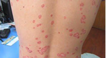 ³¤´º²©ÈóÒøÐ¼²¡Ò½Ôº ³¤´º²©ÈóÒøÐ¼²¡Ò½Ôº