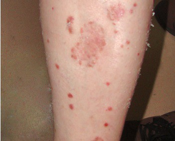 ����������м��ҽԺ