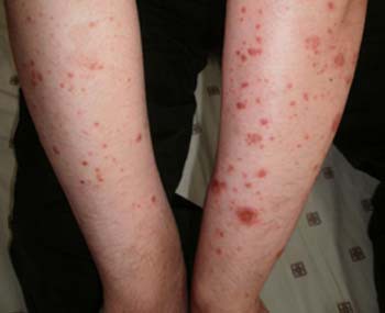 ����������м��ҽԺ