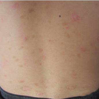 ����������м��ҽԺ