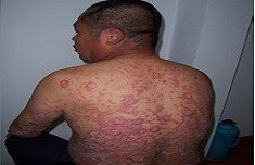 ³¤´º²©ÈóÒøÐ¼²¡Ò½Ôº ³¤´º²©ÈóÒøÐ¼²¡Ò½Ôº