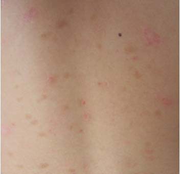 ³¤´º²©ÈóÒøÐ¼²¡Ò½Ôº ³¤´º²©ÈóÒøÐ¼²¡Ò½Ôº