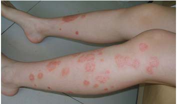 ����������м��ҽԺ