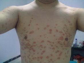 ����������м��ҽԺ