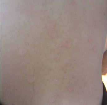 ����������м��ҽԺ