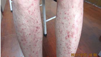 ³¤´º²©ÈóÒøÐ¼²¡Ò½Ôº ³¤´º²©ÈóÒøÐ¼²¡Ò½Ôº