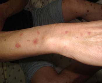 ����������м��ҽԺ