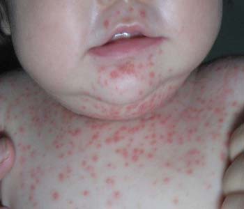 ����������м��ҽԺ