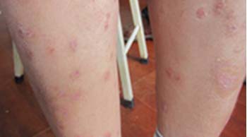 ����������м��ҽԺ