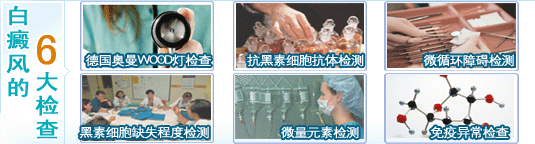 白癜风六大检查
