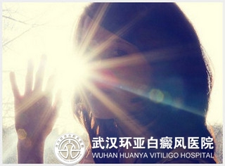 女性白癜风患者要注意哪些事项