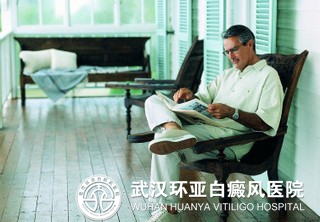 成人白癜风怎么治疗好
