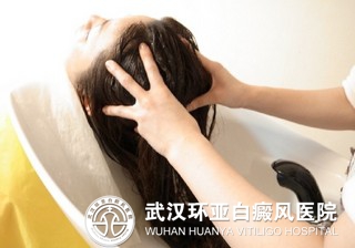 女性白癜风患者注意哪些事项