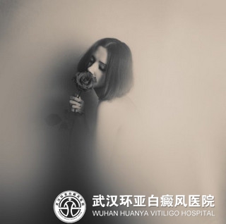 女性白癜风是由于什么引起的