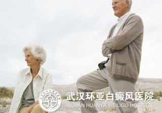 老人白癜风治疗有哪些方法